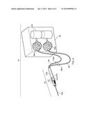 Device for Performing Regional Anesthesia diagram and image