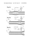 BLOOD VISCOSITY MEASURING METHOD AND SYSTEM diagram and image