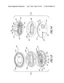 NEGATIVE PRESSURE WOUND THERAPY APPARATUS diagram and image