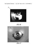 NEGATIVE PRESSURE WOUND THERAPY APPARATUS diagram and image