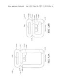 NEGATIVE PRESSURE WOUND THERAPY APPARATUS diagram and image