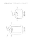 NEGATIVE PRESSURE WOUND THERAPY APPARATUS diagram and image