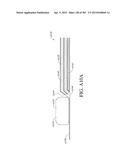 NEGATIVE PRESSURE WOUND THERAPY APPARATUS diagram and image