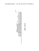 NEGATIVE PRESSURE WOUND THERAPY APPARATUS diagram and image