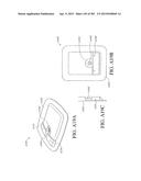 NEGATIVE PRESSURE WOUND THERAPY APPARATUS diagram and image