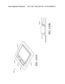 NEGATIVE PRESSURE WOUND THERAPY APPARATUS diagram and image