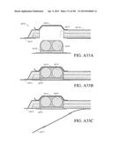 NEGATIVE PRESSURE WOUND THERAPY APPARATUS diagram and image