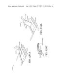 NEGATIVE PRESSURE WOUND THERAPY APPARATUS diagram and image