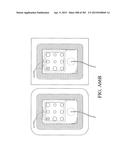 NEGATIVE PRESSURE WOUND THERAPY APPARATUS diagram and image