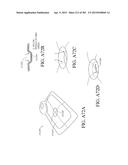 NEGATIVE PRESSURE WOUND THERAPY APPARATUS diagram and image