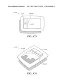 NEGATIVE PRESSURE WOUND THERAPY APPARATUS diagram and image