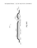 NEGATIVE PRESSURE WOUND THERAPY APPARATUS diagram and image