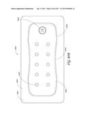 NEGATIVE PRESSURE WOUND THERAPY APPARATUS diagram and image