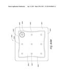 NEGATIVE PRESSURE WOUND THERAPY APPARATUS diagram and image