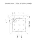 NEGATIVE PRESSURE WOUND THERAPY APPARATUS diagram and image