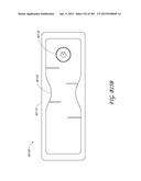 NEGATIVE PRESSURE WOUND THERAPY APPARATUS diagram and image