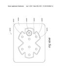 NEGATIVE PRESSURE WOUND THERAPY APPARATUS diagram and image