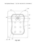 NEGATIVE PRESSURE WOUND THERAPY APPARATUS diagram and image