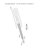 NEGATIVE PRESSURE WOUND THERAPY APPARATUS diagram and image