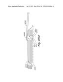 NEGATIVE PRESSURE WOUND THERAPY APPARATUS diagram and image