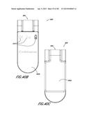 NEGATIVE PRESSURE WOUND THERAPY APPARATUS diagram and image