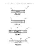 NEGATIVE PRESSURE WOUND THERAPY APPARATUS diagram and image