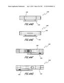 NEGATIVE PRESSURE WOUND THERAPY APPARATUS diagram and image