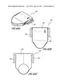 NEGATIVE PRESSURE WOUND THERAPY APPARATUS diagram and image