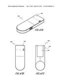 NEGATIVE PRESSURE WOUND THERAPY APPARATUS diagram and image