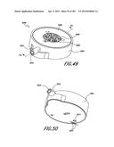 NEGATIVE PRESSURE WOUND THERAPY APPARATUS diagram and image