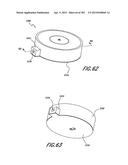 NEGATIVE PRESSURE WOUND THERAPY APPARATUS diagram and image