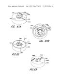 NEGATIVE PRESSURE WOUND THERAPY APPARATUS diagram and image