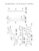 NEGATIVE PRESSURE WOUND THERAPY APPARATUS diagram and image