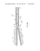 THERAPEUTIC TREATMENT APPARATUS diagram and image