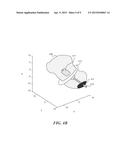 METHODS AND SYSTEMS FOR COMPUTER-GUIDED PLACEMENT OF BONE IMPLANTS diagram and image