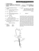 METHOD FOR PROVIDING SURGICAL ACCESS diagram and image