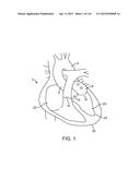 METHOD FOR PROVIDING SURGICAL ACCESS diagram and image