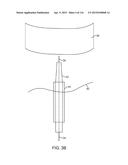 METHOD FOR PROVIDING SURGICAL ACCESS diagram and image