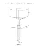 METHOD FOR PROVIDING SURGICAL ACCESS diagram and image