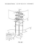 METHOD FOR PROVIDING SURGICAL ACCESS diagram and image