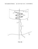 METHOD FOR PROVIDING SURGICAL ACCESS diagram and image