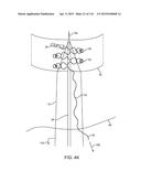 METHOD FOR PROVIDING SURGICAL ACCESS diagram and image