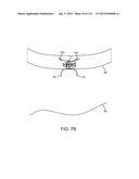 METHOD FOR PROVIDING SURGICAL ACCESS diagram and image