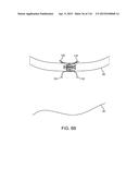 METHOD FOR PROVIDING SURGICAL ACCESS diagram and image