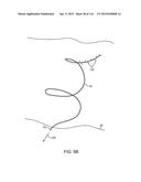 METHOD FOR PROVIDING SURGICAL ACCESS diagram and image