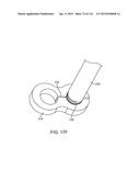 METHOD FOR PROVIDING SURGICAL ACCESS diagram and image