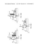 METHOD FOR PROVIDING SURGICAL ACCESS diagram and image