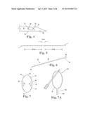 LENGTH OF SELF-RETAINING SUTURE AND METHOD AND DEVICE FOR USING THE SAME diagram and image