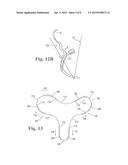 LENGTH OF SELF-RETAINING SUTURE AND METHOD AND DEVICE FOR USING THE SAME diagram and image