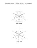 LENGTH OF SELF-RETAINING SUTURE AND METHOD AND DEVICE FOR USING THE SAME diagram and image